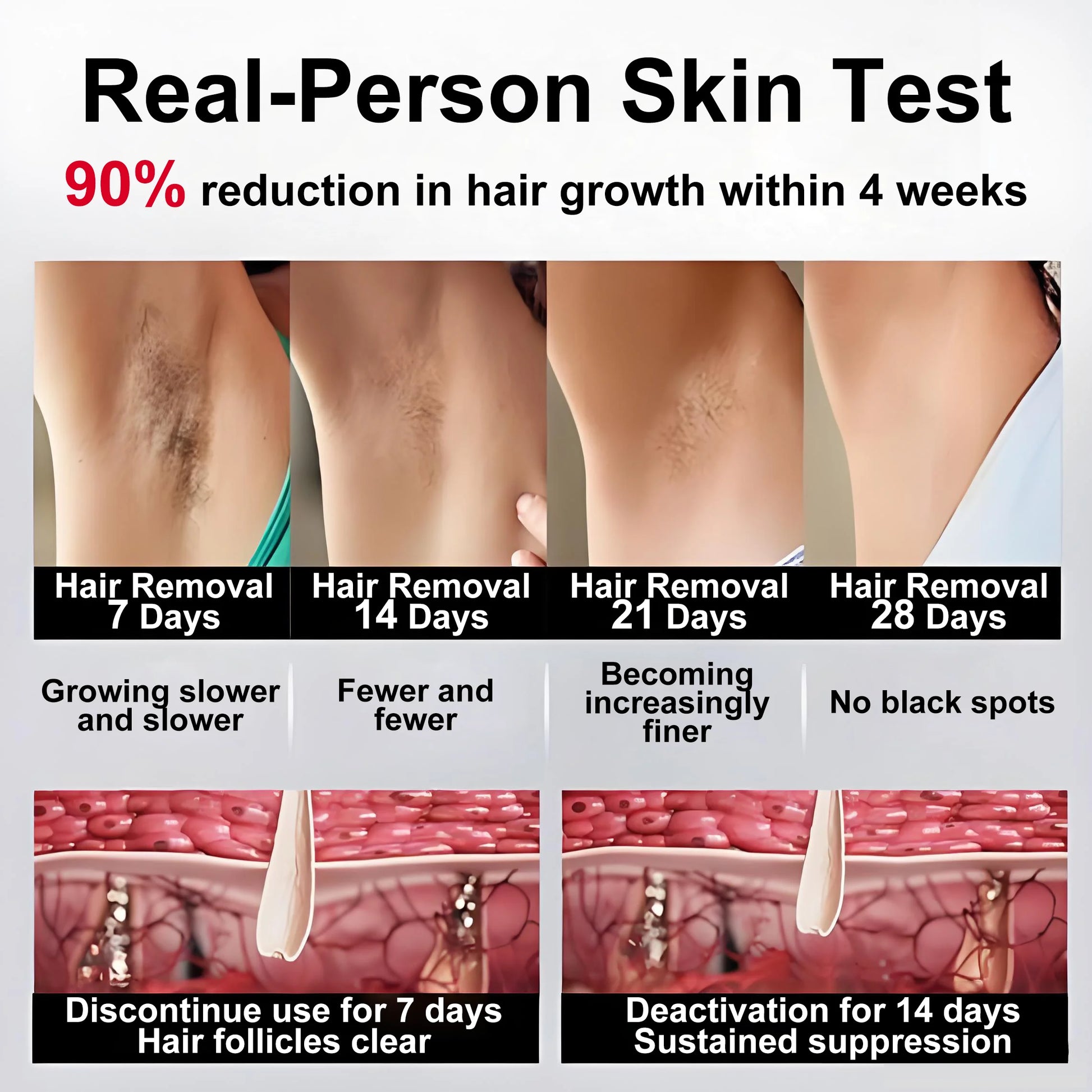 IPL Laser Hair Removal Handset – Sapphire Ice-Cooling — view 5