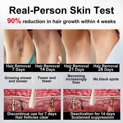 IPL Laser Hair Removal Handset – Sapphire Ice-Cooling — view 5